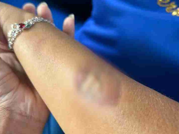 Mãe de aluno morde diretora e agride funcionárias dentro de escola no Paraná