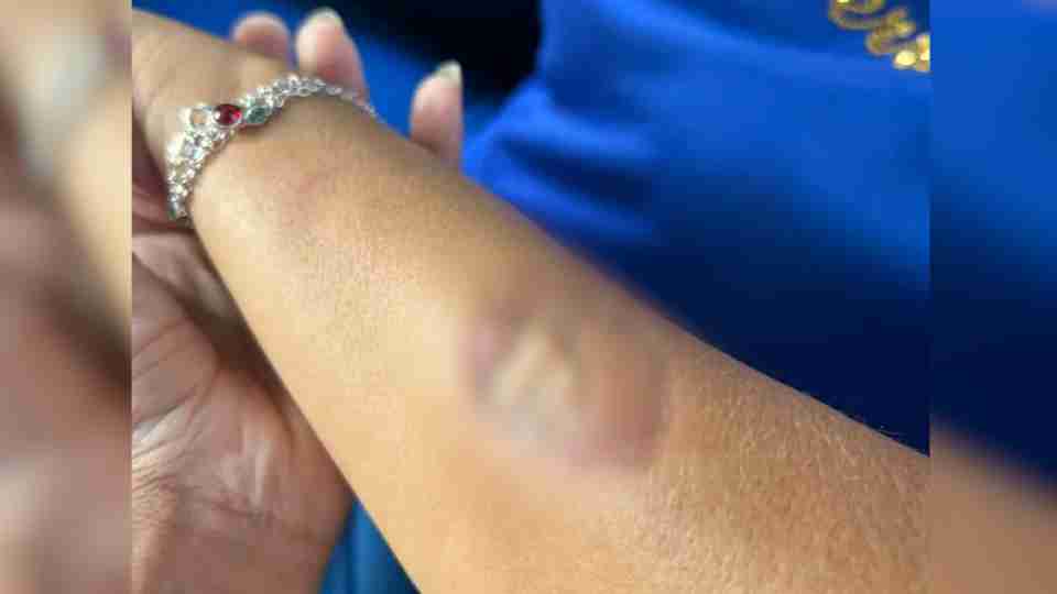 Mãe de aluno morde diretora e agride funcionárias dentro de escola no Paraná